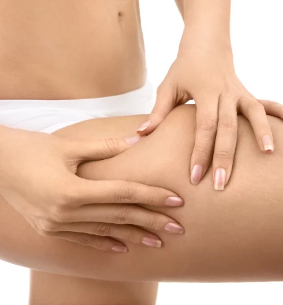Combatte la cellulite, Hello Beauty Roma