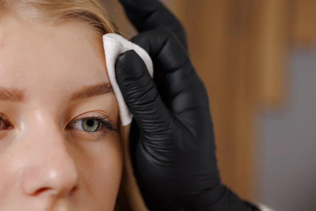 trattamento di rimozione o correzione del tatuaggio, Hello Beauty Roma