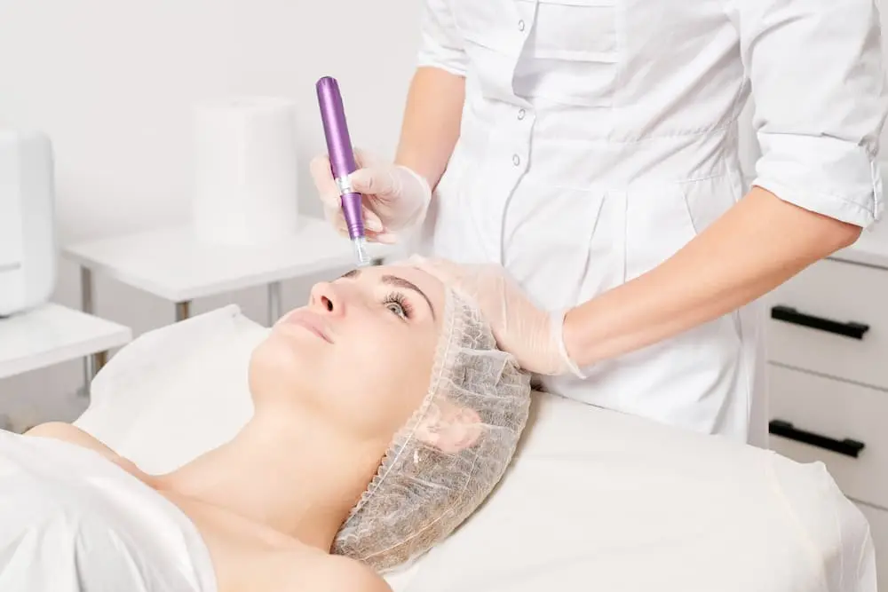 Microneedling DNA Salmon, Hello Beauty Roma