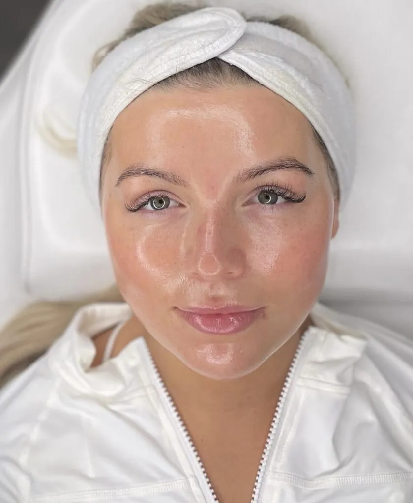 Hydrafacial viso, Hello Beauty Roma