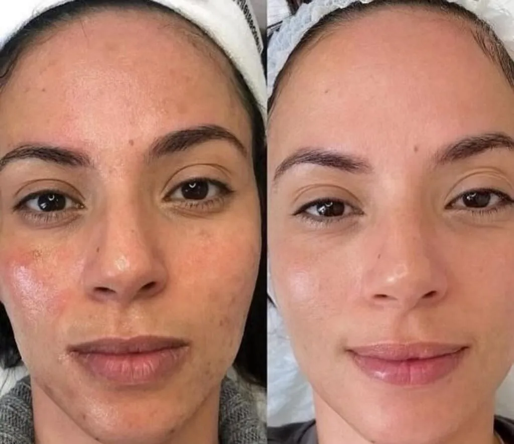 BB Glow Viso, Hello Beauty Roma