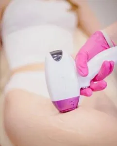 Pacchetto Epilazione Alma Soprano 10 sedute: Total Body Donna, Hello Beauty Roma