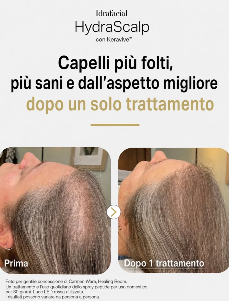 Hydrafacial Keravive, Hello Beauty Roma